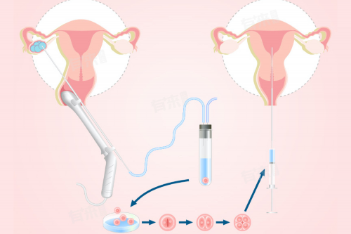 2026美国的甘肃供卵代生孩子最好的医院名单(美国甘肃供卵代生孩子医院哪家最