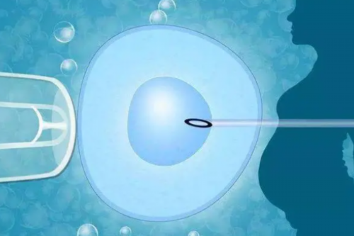 预估三代代生合法么助孕三代代生合法么总费用多少钱