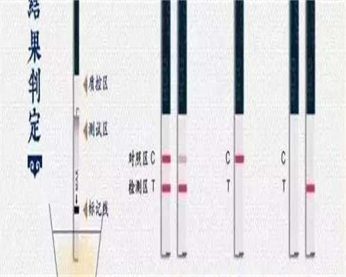 试管婴儿腹水怎么处理的？试管婴儿腹水怎么处理的啊？