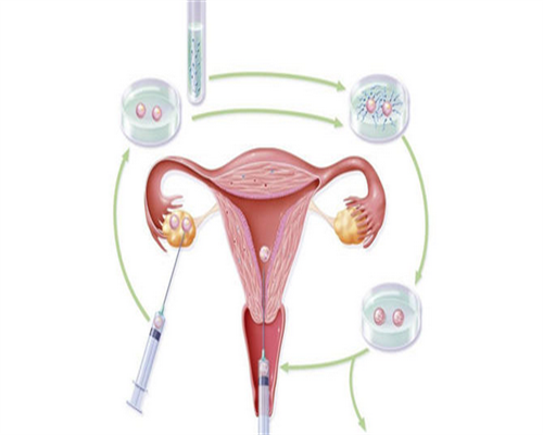 地贫可以做三代试管选性别吗？夫妻地贫做三代试管生男生女几率