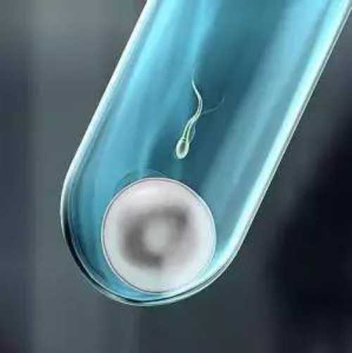 乌海想找代生试管选的男孩B超女孩