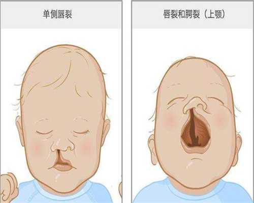 三代代生需要多少费用助孕选男女费用大概是多少钱(三代代生需要多少费用三