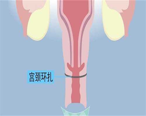 试管拮抗剂方案怎么样？是不是最差的解决方案？