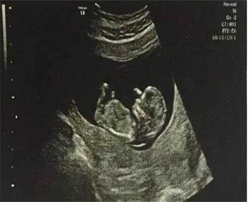 内蒙古妇保院供卵借卵代生单周期多少钱？