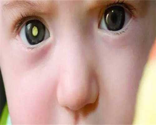 遵义第三代试管婴儿哪些医院遵义医学院第三代试管婴儿